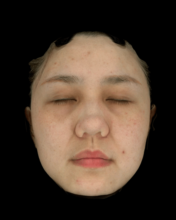 Cross Polarized Light